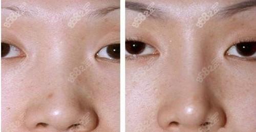 林徽因墓碑_林徽因的坟墓_林徽因墓前是谁写的
