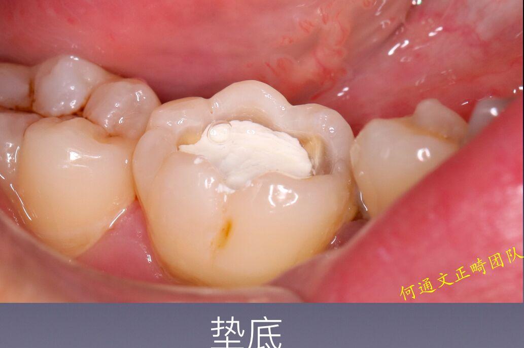 林徽因墓前是谁写的_林徽因的坟墓_林徽因墓碑