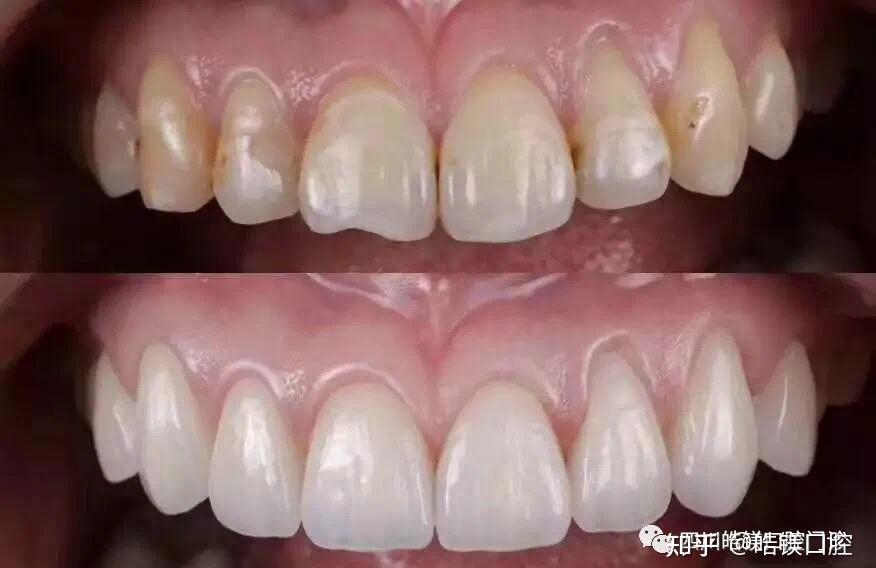 林徽因的坟墓_林徽因墓前是谁写的_林徽因墓碑